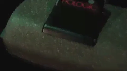 Hologic Delphi Bone Desitometer Converted to Discovery in '0