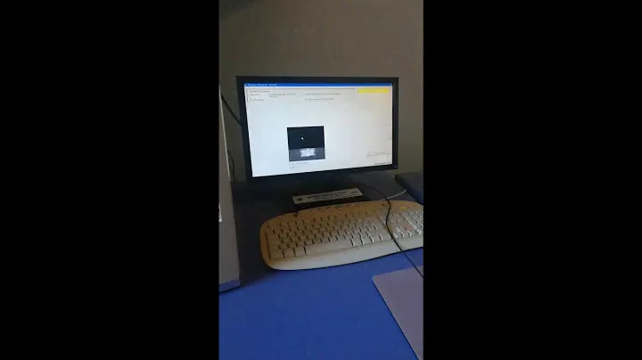 Hologic Explorer bone densitometer